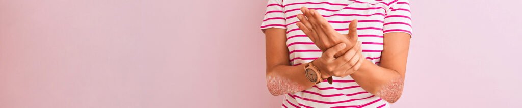 , Artrite psoriasica, malattia reumatica o dermatologica? Conoscere e comunicare una patologia complessa