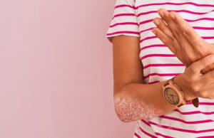 Artrite psoriasica, malattia reumatica o dermatologica? Conoscere e comunicare una patologia complessa