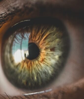 Psoriasi agli occhi, cos’è, da cosa dipende e come curarla