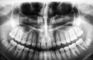 Bone Music: quando la musica proibita viaggiava sulle radiografie sovietiche