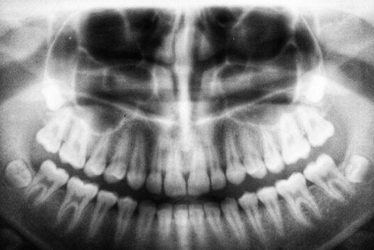 Bone Music: quando la musica proibita viaggiava sulle radiografie sovietiche No#News la rivista dell'ozio e della serendipità, Ozio e serendipità