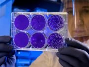 Batteri come pennelli: l’agar art, la forma d’arte che nasce nei laboratori scientifici