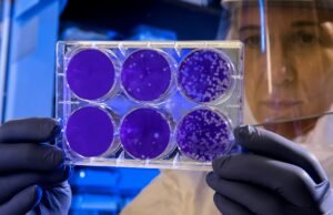 Batteri come pennelli: l’agar art, la forma d’arte che nasce nei laboratori scientifici