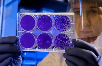 Batteri come pennelli: l’agar art, la forma d’arte che nasce nei laboratori scientifici No News la rivista dell'ozio e della serendipità, Ozio e serendipità