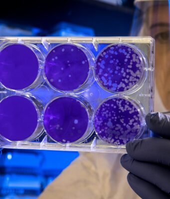 Batteri come pennelli: l’agar art, la forma d’arte che nasce nei laboratori scientifici