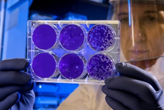 Batteri come pennelli: l’agar art, la forma d’arte che nasce nei laboratori scientifici No News la rivista dell'ozio e della serendipità, Ozio e serendipità