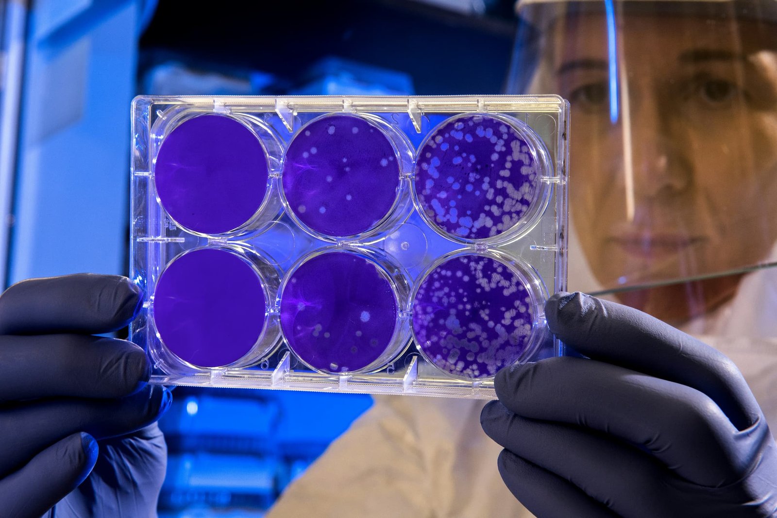 batteri come pennelli l8217agar art la forma d8217arte che nasce nei laboratori scientifici da Nonewsmagazine.com batteri come pennelli l8217agar art la forma d8217arte che nasce nei laboratori scientifici